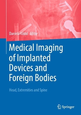 Medical Imaging of Implanted Devices and Foreign Bodies: Head, Extremities and Spine 2024 ed.