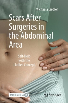 Scars After Surgeries in the Abdominal Area: Self-Help with the Liedler-Concept