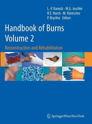 Handbook of Burns Volume 2: Reconstruction and Rehabilitation 2012