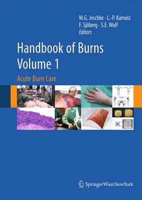 Handbook of Burns Volume 1: Acute Burn Care Softcover reprint of the original 1st ed. 2012