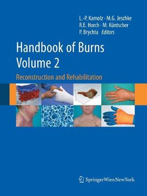 Handbook of Burns Volume 2: Reconstruction and Rehabilitation Softcover reprint of the original 1st ed. 2012