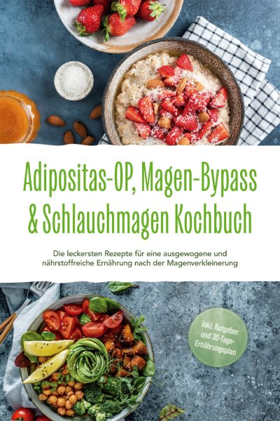 Adipositas-OP, Magen-Bypass & Schlauchmagen Kochbuch: Die leckersten Rezepte fÃ¼r eine ausgewogene und nÃ¤hrstoffreiche ErnÃ¤hrung nach der Magenverkleinerung - inkl. Ratgeber und 30-Tage-ErnÃ¤hrungsplan