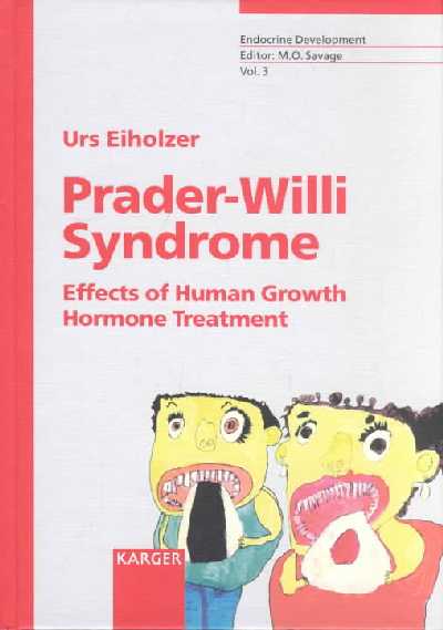 Prader-Willi Syndrome: Effects of Human Growth Hormone Treatment