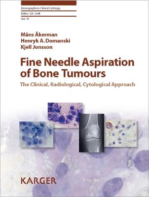 Fine Needle Aspiration of Bone Tumours: The Clinical, Radiological, Cytological Approach