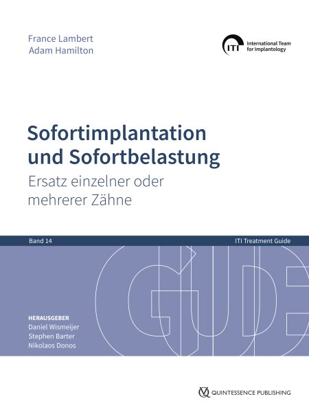 Sofortimplantation und Sofortbelastung: Ersatz einzelner oder mehrerer Zahne