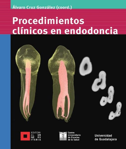 Procedimientos clÃ­nicos en endodoncia