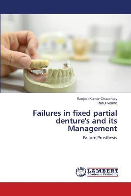 Failures in fixed partial denture's and its Management