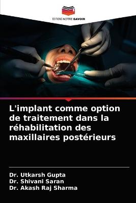 L'implant comme option de traitement dans la réhabilitation des maxillaires  postérieurs