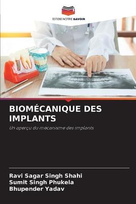Biomécanique Des Implants