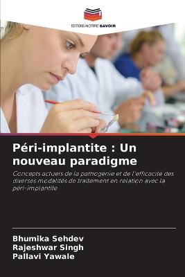 Péri-implantite: Un nouveau paradigme