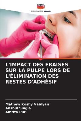 L'Impact Des Fraises Sur La Pulpe Lors de l'Élimination Des Restes d'Adhésif