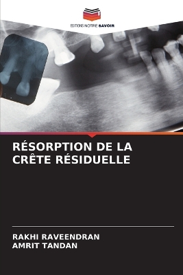 Résorption de la Crête Résiduelle
