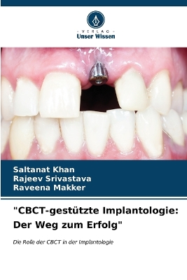 CBCT-gestützte Implantologie: Der Weg zum Erfolg