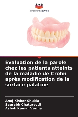 Évaluation de la parole chez les patients atteints de la maladie de Crohn  après modification de la surface palatine