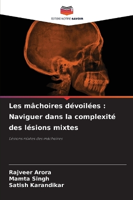 Les mâchoires dévoilées: Naviguer dans la complexité des lésions mixtes