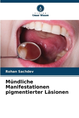 Mündliche Manifestationen pigmentierter Läsionen