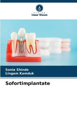 Sofortimplantate