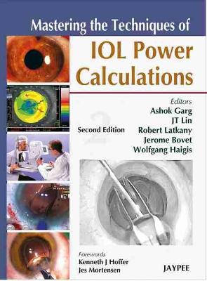 Mastering the Techniques of IOL Power Calculations 2nd Revised edition