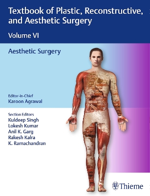 Textbook of Plastic, Reconstructive, and Aesthetic Surgery, Vol 6: Aesthetic Surgery