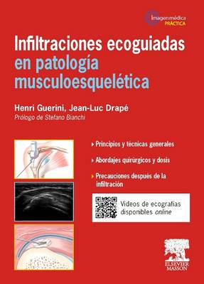 Infiltraciones ecoguiadas en patologÃ­a musculoesquelÃ©tica