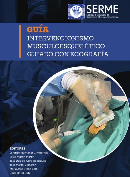 Intervencionismo musculoesquelÃ©tico guiado con ecografÃ­a
