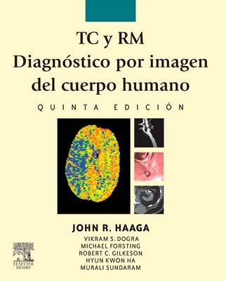 TC y RM. DiagnÃ³stico por imagen del cuerpo humano