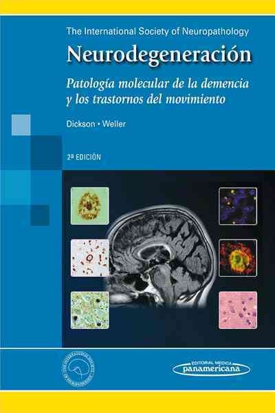 Neurodegeneracion / Neurodegeneration: Patologia Molecular De La Demencia Y Los Trastornos Del Movimiento / Molecular Pathology of Dementia and Movement Disorders 2