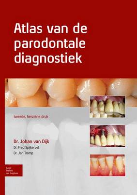 Atlas Van de Parodontale Diagnostiek 2nd 2011 ed.