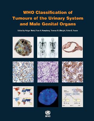 WHO classification of tumours of the urinary system and male genital organs 4th ed