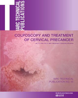 Colposcopy and treatment of cervical precancer