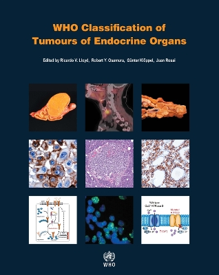 WHO classification of tumours of endocrine organs 4th ed