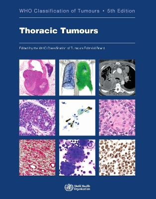 Thoracic tumours 5th ed., 2021