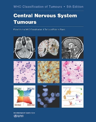 WHO classification of tumours of the central nervous system 5th ed
