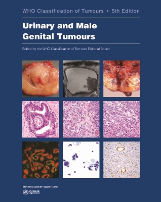 WHO classification of tumours of the urinary system and male genital organs 5th ed