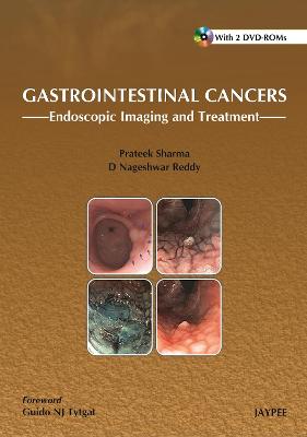 Gastrointestinal Cancers:: Endoscopic Imaging and Treatment