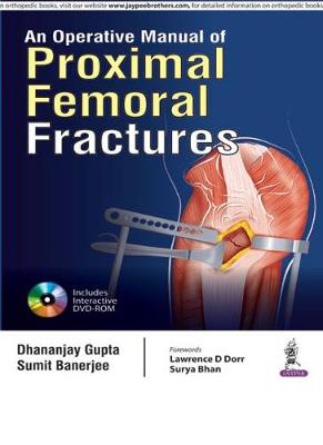 Operative Manual of Proximal Femoral Fractures
