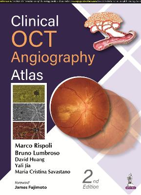Clinical OCT Angiography Atlas 2nd Revised edition