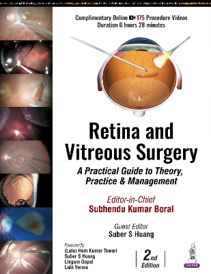 Retina and Vitreous Surgery: A Practical Guide to Theory, Practice & Management 2nd Revised edition