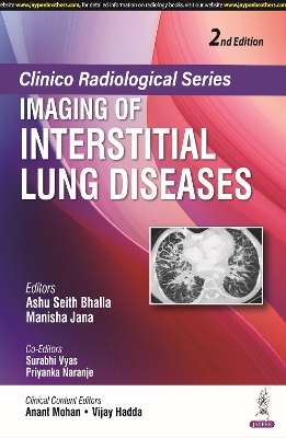Clinico Radiological Series: Imaging of Interstitial Lung Diseases