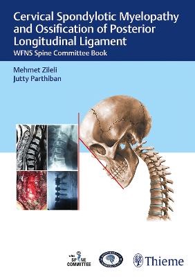 Cervical Spondylotic Myelopathy and Ossification of Posterior Longitudinal Ligament: WFNS Spine Committee Book