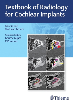 Textbook of Radiology for Cochlear Implants New edition