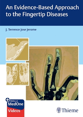Evidence-Based Approach to the Fingertip Diseases New edition