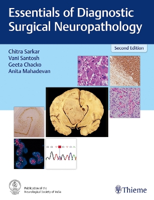 Essentials of Diagnostic Surgical Neuropathology 2nd New edition
