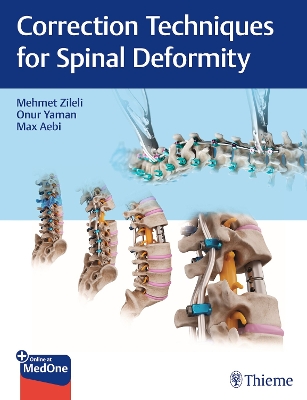 Correction Techniques for Spinal Deformity New edition