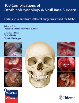 100 Complications of Otorhinolaryngology & Skull Base Surgery: Each Case Report from Different Surgeons Around the Globe New edition