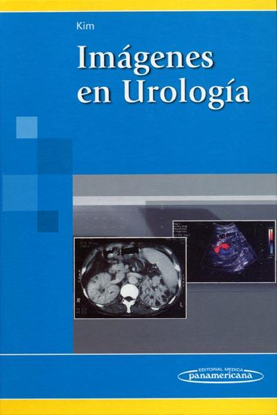 Imagenes En Urologia