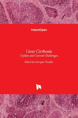 Liver Cirrhosis: Update and Current Challenges
