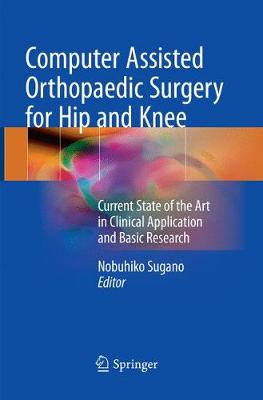 Computer Assisted Orthopaedic Surgery for Hip and Knee: Current State of the Art in Clinical Application and Basic Research Softcover Reprint of the Original 1st 2018 ed.