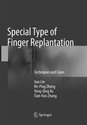 Special Type of Finger Replantation: Techniques and Cases Softcover Reprint of the Original 1st 2018 ed.
