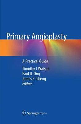 Primary Angioplasty: A Practical Guide Softcover Reprint of the Original 1st 2018 ed.